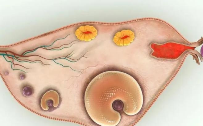 盆腔局部粘连，为什么排不出卵？