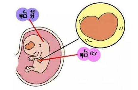 试管移植成功之后但是没有胎心的原因是什么？