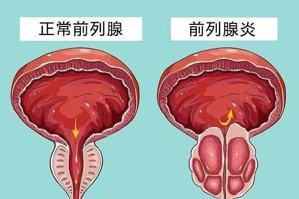 阴囊潮湿试管婴儿成功率高不高能不能一次成功？