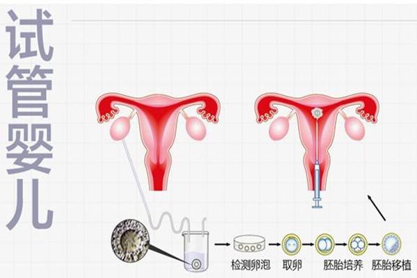 始基子宫南京哪个公立医院能够做试管婴儿且成功率高？