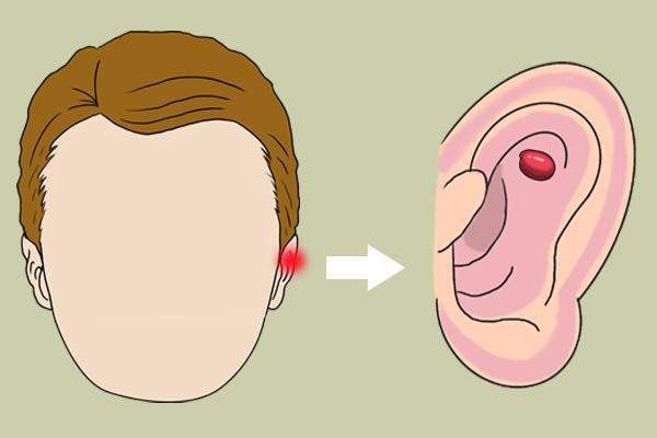 耳朵胆脂瘤有什么症状？该怎么治疗呢？