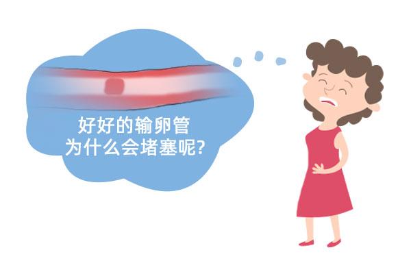 如果只有一侧输卵管堵塞，做试管婴儿会成功吗？