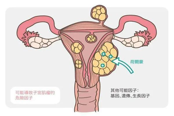 子宫肌瘤患者在上海九院做三代试管婴儿的成功率高吗？