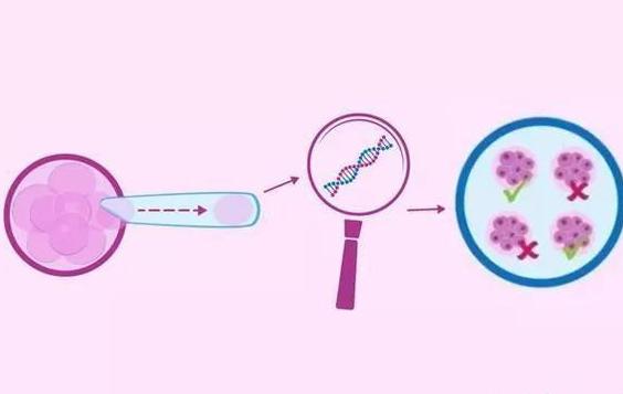 做三代试管婴儿pGT筛查要花费多长时间？