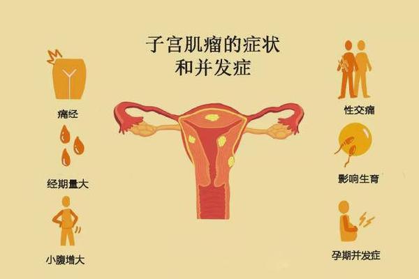 子宫肌瘤患者调养后可以做试管婴儿吗？如何预防子宫肌瘤？