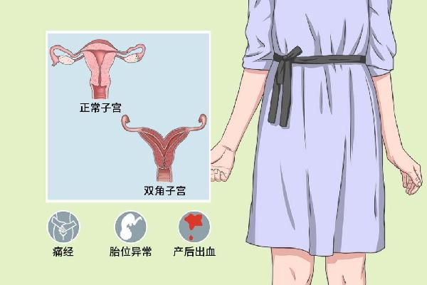 双角子宫患者想做试管婴儿，应该在上海九院做还是中山六院做？