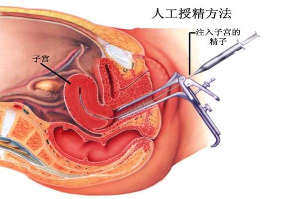 人工周期移植的成功率与自然周期相比有何不同？