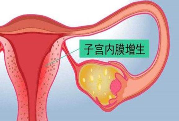 试管人工周期移植后吃补佳乐能影响内膜长期增生吗？