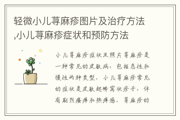 轻微小儿荨麻疹图片及治疗方法,小儿荨麻疹症状和预防方法