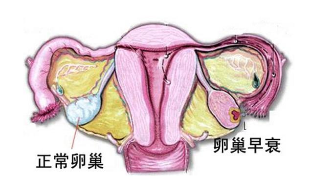 试管婴儿对AMH值有什么要求？