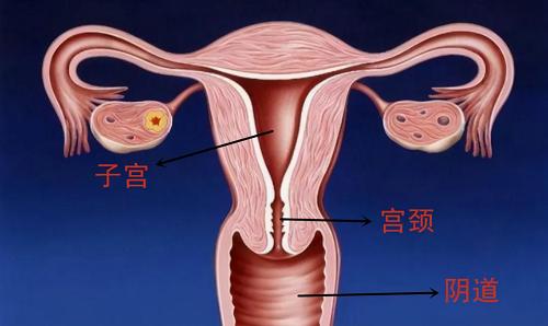 双角子宫可以做泰国试管婴儿吗？