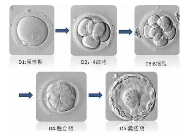 诊刮后多久可以移植冻胚，一文带你了解