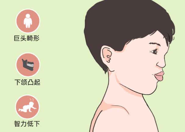 Sotos综合征担心会遗传，可以选择做三代试管筛查疾病