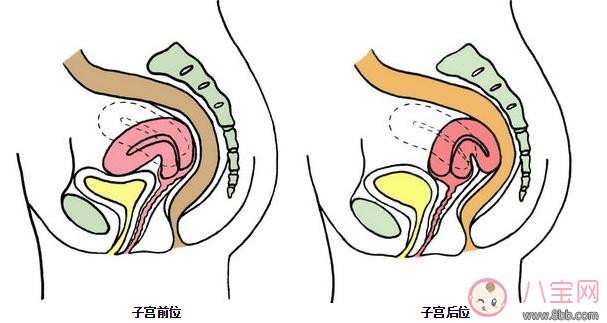 子宫后位怎么怀上 子宫后卫受孕姿势