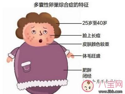 患多囊不能怀孕吗 要备孕学天王嫂昆凌怀二胎