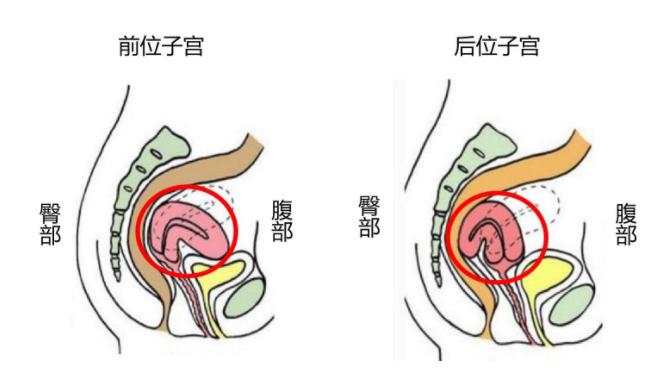 子宫前位能影响怀孕吗？看完这篇文章你就懂了