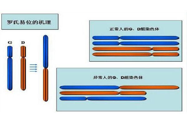 染色体平衡易位做三代试管要多少钱？费用和效果之间如何平衡