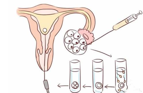 试管婴儿从取卵到植入，不同情况下需要多久？