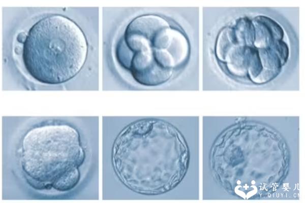 只有两个囊胚做三代试管能成功吗？一分钟为你揭晓成功率
