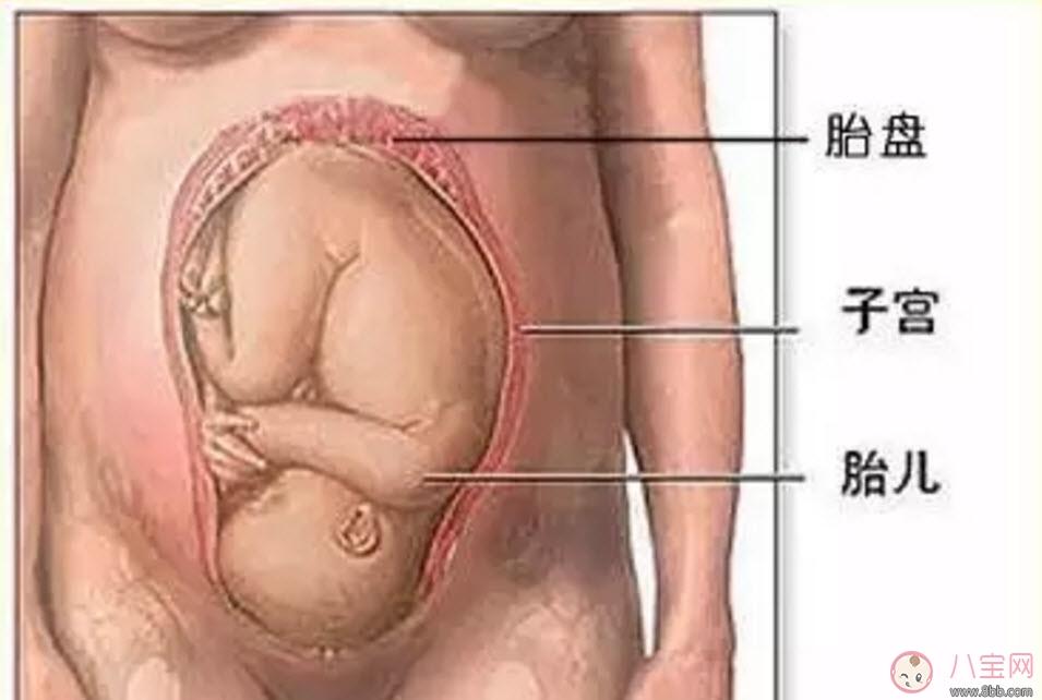 胎盘晚熟预产期会推迟吗 胎盘成熟度1级能分娩吗