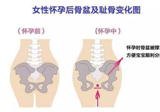 耻骨痛怎么办 孕晚期如何缓解耻骨痛