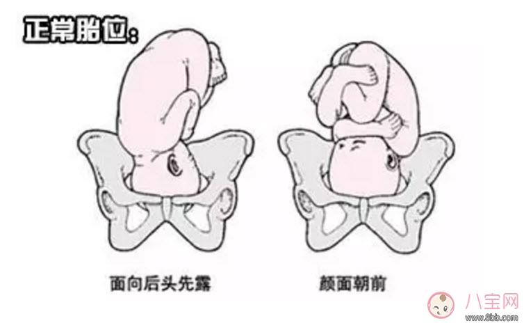 孕期胎位不正的原因 如何矫正胎位不正