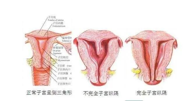 孕前需要检查子宫吗.jpg