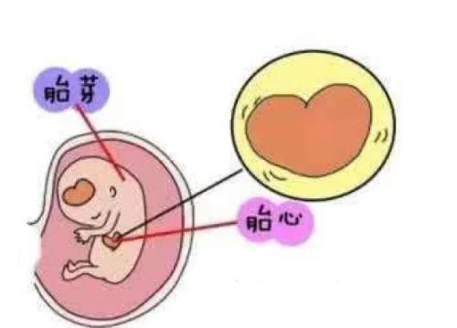 通过胎芽大小判断性别准吗