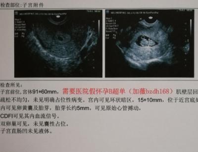 验血查怀孕最早几天可以查出来.png