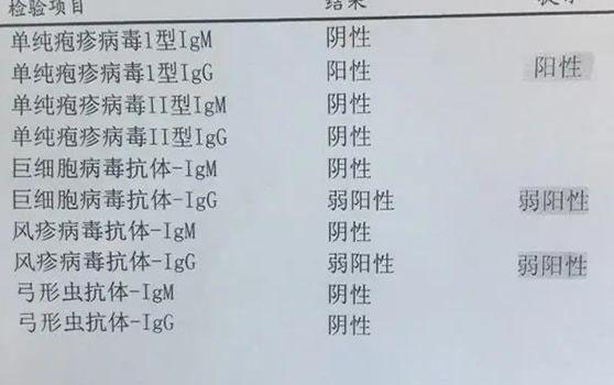 试管婴儿进周前要做检查