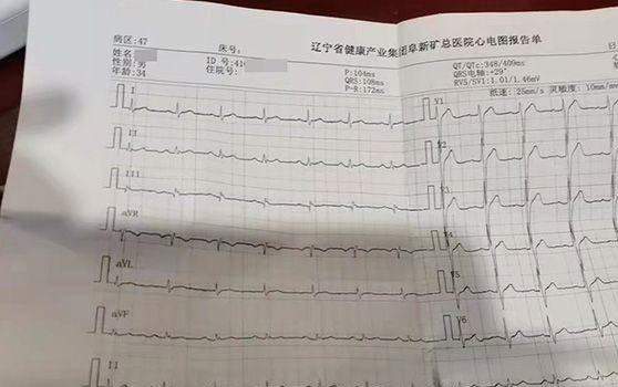 心电图检查有效期长