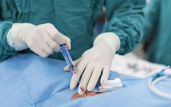 苏州市立医院取卵流程公开，提前预约挂号节省治疗时间
