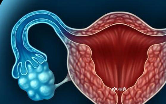闭经是诊断对多囊的必需条件