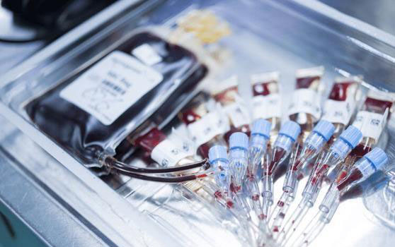 贵州脐带血捐赠机构分享，这些公共库可申请保存