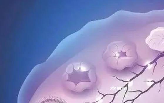 卵巢早衰的人雌激素水平低