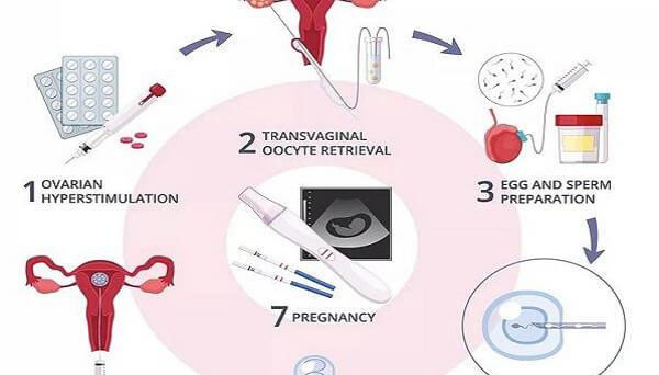 做试管婴儿需要先促排才能取卵