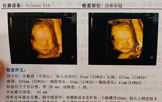 石家庄私立妇产医院排名参考，这几家四维技术都不错