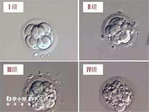 多胚胎移植会增加生育的风险