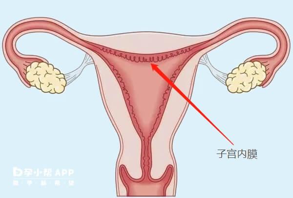 预防子宫内膜薄才是最好的应对方法