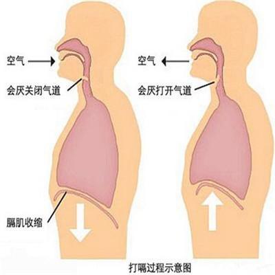 慢性支气管炎的治疗