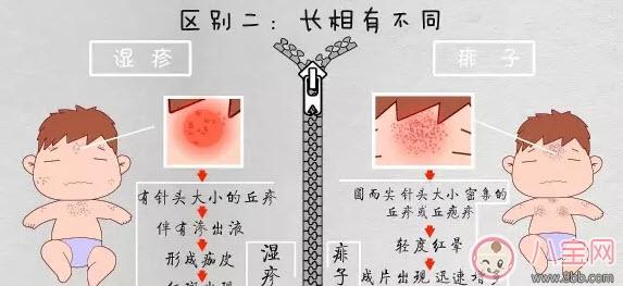 宝宝痱子和湿疹的区别 湿疹和痱子的区别图片